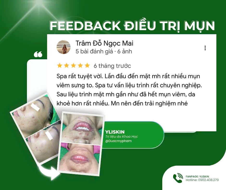 Phản hồi thực tế của khách hàng YLISKIN 4
