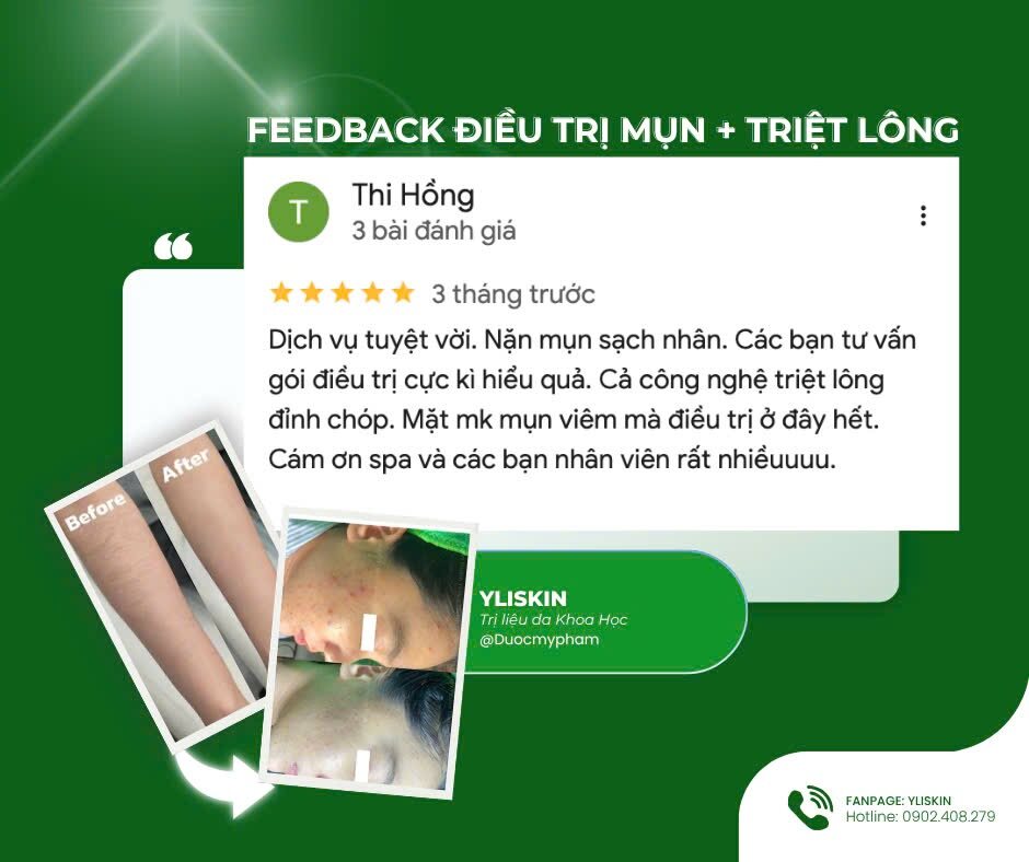 Phản hồi thực tế của khách hàng YLISKIN 5